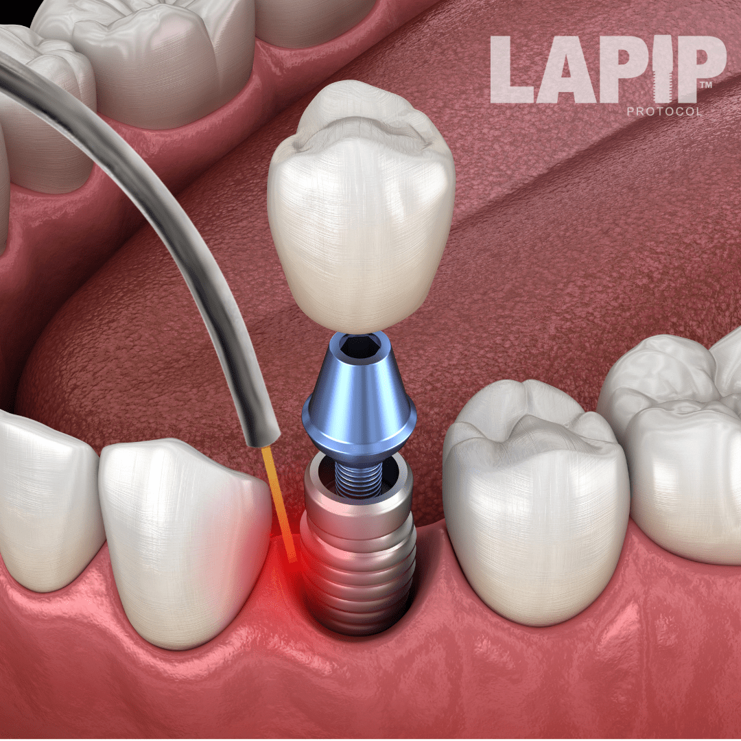Lapip – crown off – alt logo